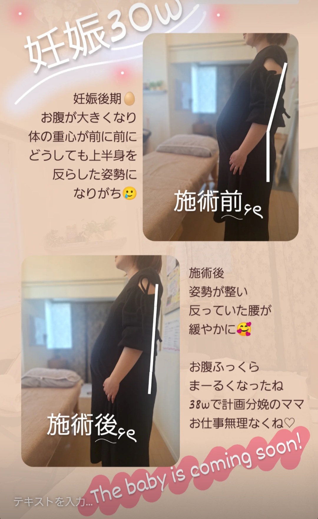 Screenshot 20250415 193954 Instagram 1 - 妊娠30週