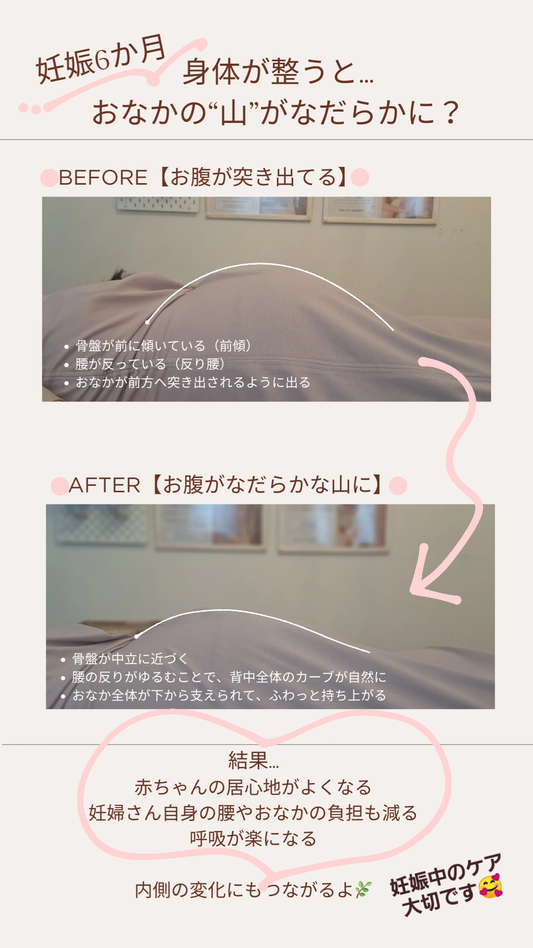IMG 20250714 152931 104 - お腹がなだらかになるマタニティ整体